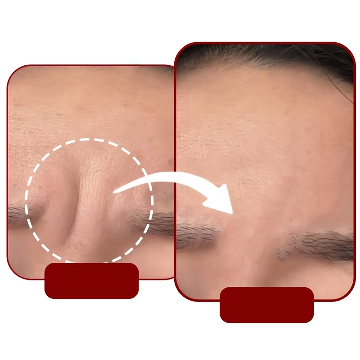 54/30/6枚入りの粘着式睡眠用額パッチ - 再利用可能な - Face Mask Silicone のレビューと価格